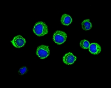 leukaemic cells