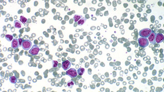 Cell image courtesy SA Pathology