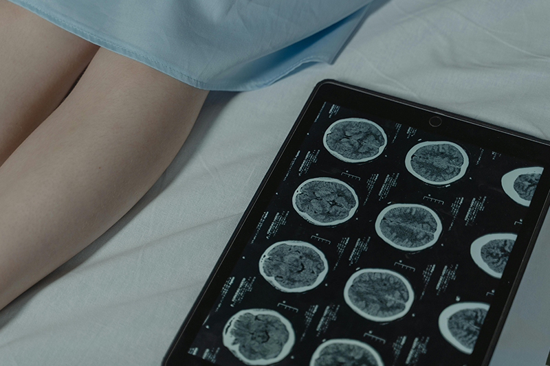 A patient lies on a hospital bed in a light blue gown. Only their shins are shown. Next to their legs lies some black and white brain scans. 