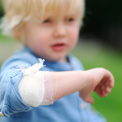 child with a sore arm 